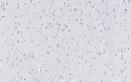 Anti-SNAP-25 Antibody, clone 1J9 ZooMAb® Rabbit Monoclonal recombinant, expressed in HEK 293 cells