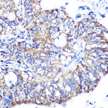 Anti-IDH2 antibody produced in rabbit