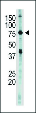 ANTI-IKK EPSILON (IKKE)(C-TERMINAL) antibody produced in rabbit IgG fraction of antiserum, buffered aqueous solution