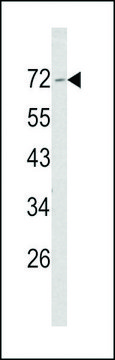 ANTI-MERLIN(N-TERMINAL) antibody produced in rabbit purified immunoglobulin, buffered aqueous solution