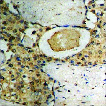 Anti-phospho-p73 (pTyr99) antibody produced in rabbit affinity isolated antibody