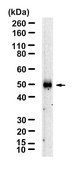 Anti-SPARC Antibody, clone 5N19 ZooMAb® Rabbit Monoclonal recombinant, expressed in HEK 293 cells