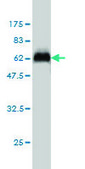 Monoclonal Anti-STK16 antibody produced in mouse clone M2, purified immunoglobulin, buffered aqueous solution