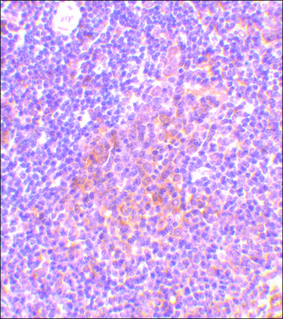 Anti-TANK (ab1) antibody produced in rabbit affinity isolated antibody, buffered aqueous solution