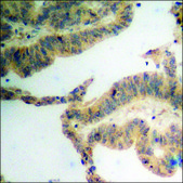 Anti-phospho-SGK (pSer78) antibody produced in rabbit affinity isolated antibody
