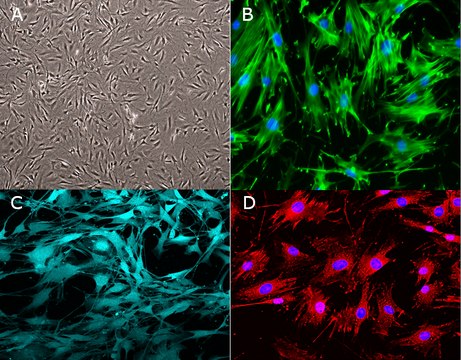 Mouse OP9-DL4-7FS Notch Ligand Cell Line