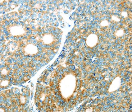 Anti-LEFTY2 affinity isolated antibody