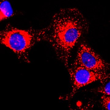 Anti-GAPDH antibody, Rabbit monoclonal recombinant, expressed in HEK 293 cells, clone RM114, purified immunoglobulin