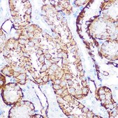 Anti-NDRG1 antibody produced in rabbit