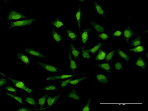 Anti-IL17C antibody produced in rabbit purified immunoglobulin, buffered aqueous solution