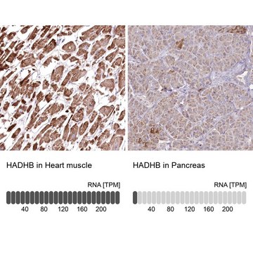 Anti-HADHB antibody produced in rabbit Prestige Antibodies&#174; Powered by Atlas Antibodies, affinity isolated antibody, buffered aqueous glycerol solution