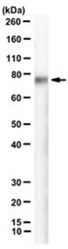 Anti-Desmoglein-2 Antibody, clone CSTEM28