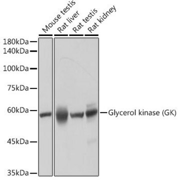 Anti-Glycerol kinase (GK) antibody produced in rabbit