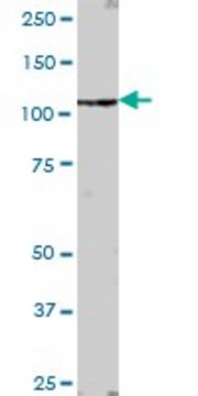 Anti-AHI1 antibody produced in mouse IgG fraction of antiserum, buffered aqueous solution