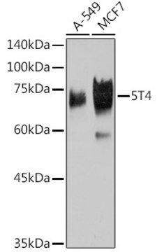 Anti-5T4 Antibody, clone 2K10S6, Rabbit Monoclonal