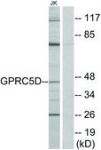 Anti-GPRC5D antibody produced in rabbit affinity isolated antibody