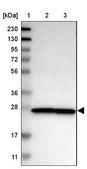 Anti-NUP35 antibody produced in rabbit Prestige Antibodies® Powered by Atlas Antibodies, affinity isolated antibody, buffered aqueous glycerol solution