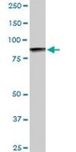 Monoclonal Anti-UBTF antibody produced in mouse clone 2C6, purified immunoglobulin, buffered aqueous solution