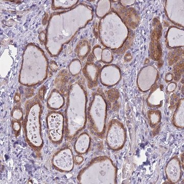 Anti-WWOX antibody produced in rabbit Prestige Antibodies&#174; Powered by Atlas Antibodies, affinity isolated antibody, buffered aqueous glycerol solution