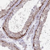 Anti-RIOK1 antibody produced in rabbit Prestige Antibodies® Powered by Atlas Antibodies, affinity isolated antibody, buffered aqueous glycerol solution