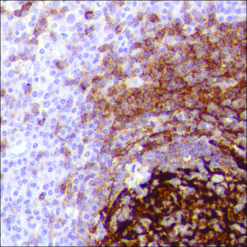 Anti-CD21 antibody, Rabbit monoclonal clone SP186, recombinant, expressed in proprietary host, affinity isolated antibody