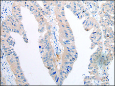 Anti-TNIK affinity isolated antibody