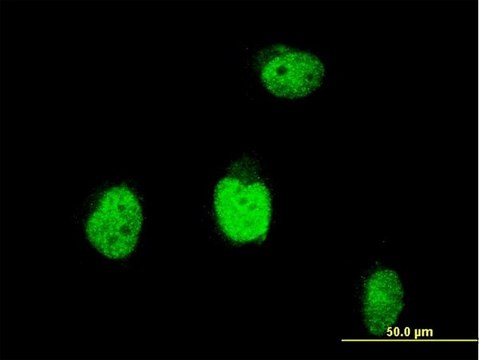 Monoclonal Anti-BLM antibody produced in mouse clone 1E4, purified immunoglobulin, buffered aqueous solution