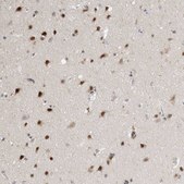 Anti-RBM6 antibody produced in rabbit Prestige Antibodies® Powered by Atlas Antibodies, affinity isolated antibody, buffered aqueous glycerol solution, Ab1