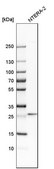 Anti-RGS7BP antibody produced in rabbit Prestige Antibodies® Powered by Atlas Antibodies, affinity isolated antibody, buffered aqueous glycerol solution