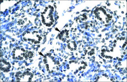 Anti-CLDN17 antibody produced in rabbit IgG fraction of antiserum