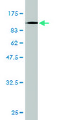 Monoclonal Anti-FLNA antibody produced in mouse clone 4E10-1B2, purified immunoglobulin, buffered aqueous solution