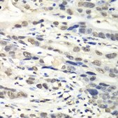 Anti-NUDT1 antibody produced in rabbit