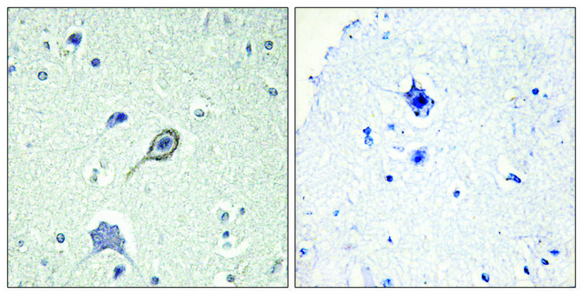 Anti-CNR1 antibody produced in rabbit affinity isolated antibody