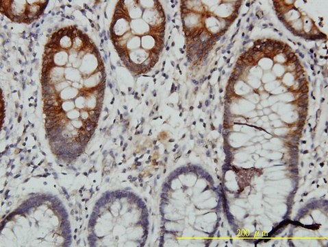 Monoclonal Anti-KRT20 antibody produced in mouse clone 2G3-1C8, purified immunoglobulin, buffered aqueous solution