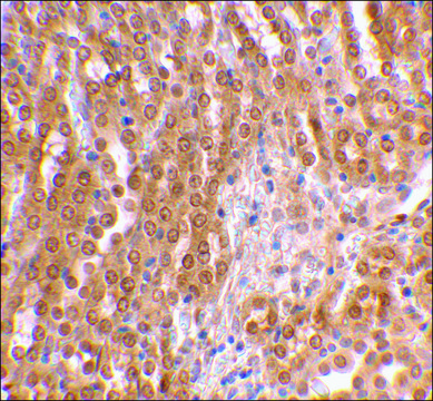 Anti-TIRP (ab2) antibody produced in rabbit affinity isolated antibody, buffered aqueous solution