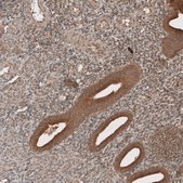 Anti-RAB11FIP3 antibody produced in rabbit Prestige Antibodies® Powered by Atlas Antibodies, affinity isolated antibody, buffered aqueous glycerol solution, ab2