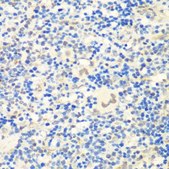 Anti-CTCF antibody produced in rabbit
