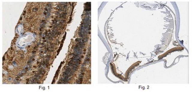 Anti-RLBP1 Antibody, clone 3C1.1 clone 3C1.1, from mouse