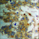 Anti-phospho-PLD1 (pSer561) antibody produced in rabbit affinity isolated antibody