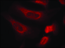Anti-phospho-STAT1 (pSer727) antibody produced in rabbit affinity isolated antibody