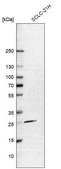 Anti-RNF41 antibody produced in rabbit Prestige Antibodies® Powered by Atlas Antibodies, affinity isolated antibody, buffered aqueous glycerol solution