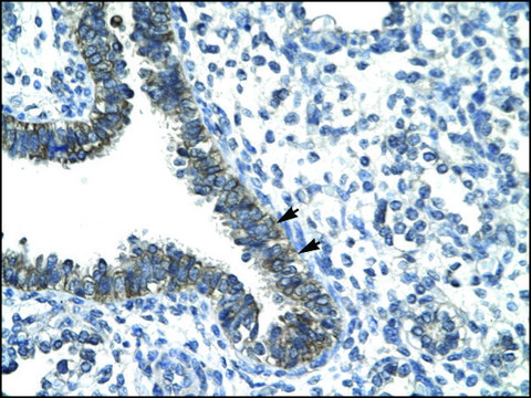 Anti-CCRN4L antibody produced in rabbit IgG fraction of antiserum