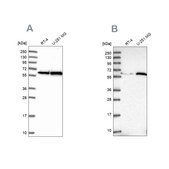 Anti-KPNA4 antibody produced in rabbit Prestige Antibodies® Powered by Atlas Antibodies, affinity isolated antibody, buffered aqueous glycerol solution
