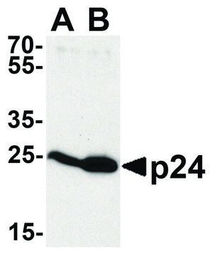 Anti-HIV-1 P24 antibody produced in rabbit affinity isolated antibody