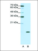 Anti-SNRPD1 antibody produced in rabbit affinity isolated antibody