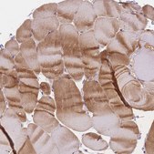 Anti-SMYD1 antibody produced in rabbit Prestige Antibodies® Powered by Atlas Antibodies, affinity isolated antibody, buffered aqueous glycerol solution