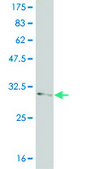 ANTI-FOXL1 antibody produced in mouse clone 2F6, purified immunoglobulin, buffered aqueous solution