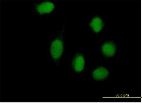 Anti-WHSC1L1 antibody produced in mouse purified immunoglobulin, buffered aqueous solution