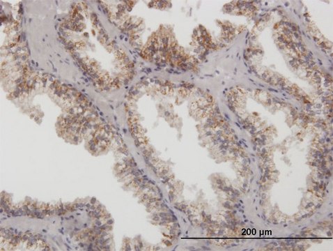 Anti-ARG2 antibody produced in mouse purified immunoglobulin, buffered aqueous solution