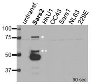 Anti-SARS-CoV-2 nucleocapsid NC1 Antibody, clone 6G3-G6